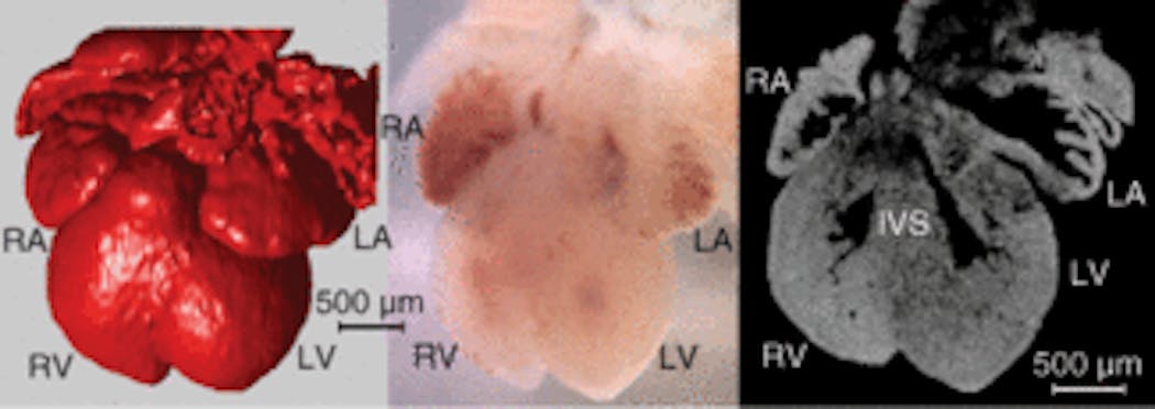 FIGURE 1. A typical presentation of a 13.5-day-old wild-type mouse heart includes a 3-D OCT image (left), a video microscope image (center), and a 2-D OCT slice sectioning the four heart chambers taken from the 3-D OCT image (right). The accurate morphological representation and exquisite detail provided by OCT imaging is readily observed (RA = right atrium; RV = right ventricle; LA = left atrium; LV = left ventricle; IVS = interventricular septum).