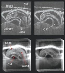 FIGURE 2. Laser Doppler velocimetry is used to obtain in vivo cardiac-gated, 2-D OCT images of an embryonic quail heart in diastole (top left) and in systole (top right), cut coronal to the body of the embryo. Sum-voxel projection images are obtained in diastole (bottom left) and in systole (bottom right). The OCT images clearly show the compact myocardial and endocardial borders of the heart and demonstrate the image quality capable with this technique, while sum-voxel projection allows interpretation of a whole 3-D dataset, where both the outer and inner surfaces are visible (CM = compact myocardium; Endo = endocardium; CJ = cardiac jelly). FIGURE 2. Laser Doppler velocimetry is used to obtain in vivo cardiac-gated, 2-D OCT images of an embryonic quail heart in diastole (top left) and in systole (top right), cut coronal to the body of the embryo. Sum-voxel projection images are obtained in diastole (bottom left) and in systole (bottom right). The OCT images clearly show the compact myocardial and endocardial borders of the heart and demonstrate the image quality capable with this technique, while sum-voxel projection allows interpretation of a whole 3-D dataset, where both the outer and inner surfaces are visible (CM = compact myocardium; Endo = endocardium; CJ = cardiac jelly).