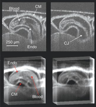 FIGURE 2. Laser Doppler velocimetry is used to obtain in vivo cardiac-gated, 2-D OCT images of an embryonic quail heart in diastole (top left) and in systole (top right), cut coronal to the body of the embryo. Sum-voxel projection images are obtained in diastole (bottom left) and in systole (bottom right). The OCT images clearly show the compact myocardial and endocardial borders of the heart and demonstrate the image quality capable with this technique, while sum-voxel projection allows interpretation of a whole 3-D dataset, where both the outer and inner surfaces are visible (CM = compact myocardium; Endo = endocardium; CJ = cardiac jelly).