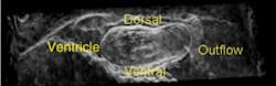 FIGURE 3. The top view (ventral) of a 2-day-old embryonic quail heart (with borders enhanced prior to OCT volume rendering) shows the interaction between the heart tube and the surrounding tissue. FIGURE 3. The top view (ventral) of a 2-day-old embryonic quail heart (with borders enhanced prior to OCT volume rendering) shows the interaction between the heart tube and the surrounding tissue.