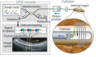 FIGURE 3. In an optical frequency-domain imaging system, minimally invasive catheters or endoscopes give the optical fiber access to the organ or system of interest. An optical beam is focused into the tissue, and the echo-time delay and amplitude of light reflected from the tissue microstructure at different depths are determined by detecting spectrally resolved interference between the tissue sample and a reference, as the source laser wavelength is rapidly varied from 1264 to 1376 nm. A Fourier transform of this signal forms image data along the axial line (A-line).