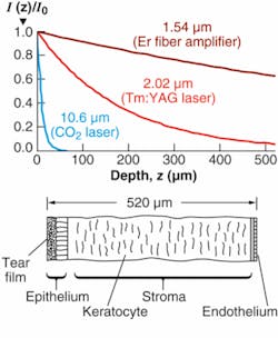 FIGURE 2. Relative irradiance of laser light below the surface of the cornea is shown for three important laser lines. Absorption at the CO2 line is so strong that most of the energy is deposited in the epithelium, the outer layer of the cornea, making damage likely. The 1.54 µm Er-glass laser deposits much less energy per unit depth because absorption is lower. The lower part of figure shows a cross section of the cornea. FIGURE 2. Relative irradiance of laser light below the surface of the cornea is shown for three important laser lines. Absorption at the CO2 line is so strong that most of the energy is deposited in the epithelium, the outer layer of the cornea, making damage likely. The 1.54 µm Er-glass laser deposits much less energy per unit depth because absorption is lower. The lower part of figure shows a cross section of the cornea.