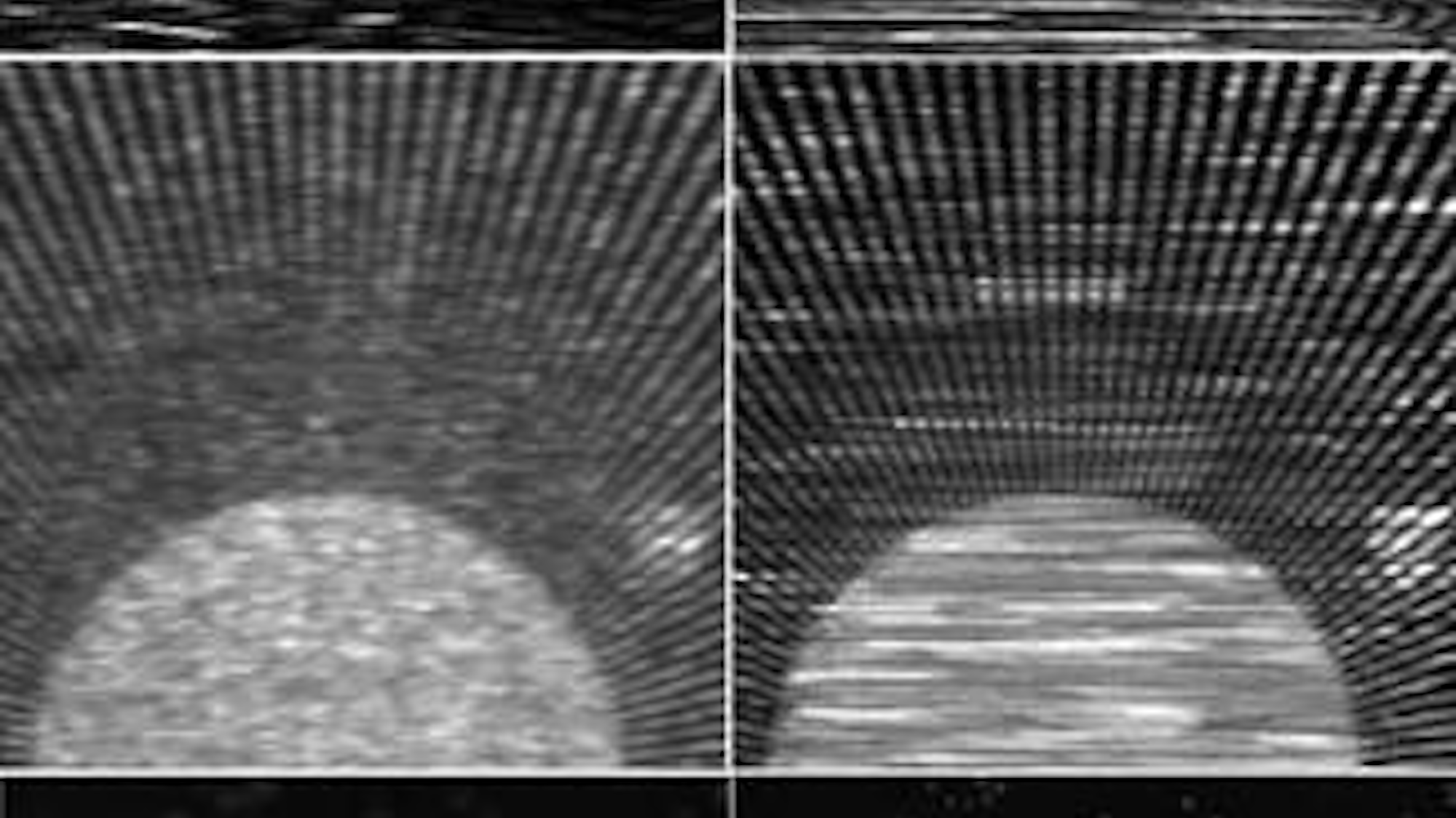 Superresolution Optics: Optical imaging resolves beyond the diffraction ...