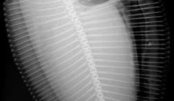 FIGURE 4. An x-ray image of a fish was obtained with the DALSA 3k x 4k imager. FIGURE 4. An x-ray image of a fish was obtained with the DALSA 3k x 4k imager.