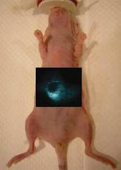 The liver of an anesthetized nude mouse is imaged using Raman spectroscopy and Raman-active nanoparticles that are trapped specifically in the liver cells. The liver of an anesthetized nude mouse is imaged using Raman spectroscopy and Raman-active nanoparticles that are trapped specifically in the liver cells.