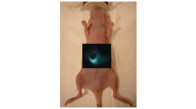 The liver of an anesthetized nude mouse is imaged using Raman spectroscopy and Raman-active nanoparticles that are trapped specifically in the liver cells.