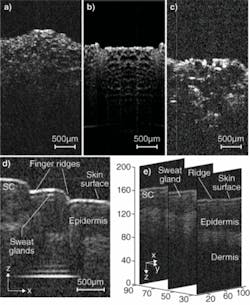 FIGURE 3. Images of biological samples were taken using a micromirror-based SS-OCT system. Two-dimensional images were acquired at 40 frames/s, and 3-D images at 10 million voxels/s. Shown are a tomographic image of a pickle slice having a lateral scan width of 2 mm (a); an image of a pickle slice at a different location using a galvanometric scanner (b); an image of an onion peel using a micromirror (c); a single slice from 3-D data of human finger imaged in vivo (d); and tomographic slices of 3-D volumetric data obtained from human finger skin, with each slice having a lateral extent of 1 mm (100 pixels) (e). FIGURE 3. Images of biological samples were taken using a micromirror-based SS-OCT system. Two-dimensional images were acquired at 40 frames/s, and 3-D images at 10 million voxels/s. Shown are a tomographic image of a pickle slice having a lateral scan width of 2 mm (a); an image of a pickle slice at a different location using a galvanometric scanner (b); an image of an onion peel using a micromirror (c); a single slice from 3-D data of human finger imaged in vivo (d); and tomographic slices of 3-D volumetric data obtained from human finger skin, with each slice having a lateral extent of 1 mm (100 pixels) (e).