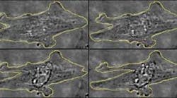 These images illustrate the contraction of a single cardiomyocyte under the influence of laser irradiation.