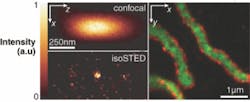 Different proteins within mitochondria are tagged with different fluorophores and imaged using the isoSTED technique at a resolution of roughly 50 nm. Different proteins within mitochondria are tagged with different fluorophores and imaged using the isoSTED technique at a resolution of roughly 50 nm.