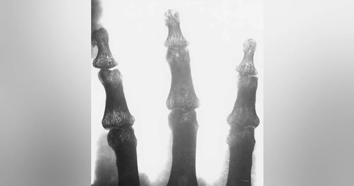 Cool X Rays Carbon nanotubes generate cool x-rays | Laser Focus World