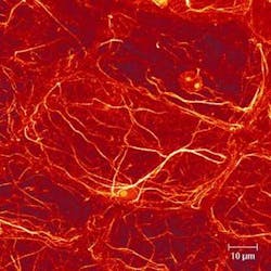 FIGURE 1. Laser-scanning confocal microscopes can produce striking, and enormously useful images of the three-dimensional structure of cells. Here, the structure of an Alaska pea is revealed by an LSCM using a 568-nm excitation line. The image was produced at the Laboratory of Molecular Cell Biology, Dept. Bio-Resources, College of Agriculture, Ehime University, Matsuyama, Japan, by scanning the pinhole aperture over the entire volume of the sample and feeding the point-by-point data into a computer for reconstruction. FIGURE 1. Laser-scanning confocal microscopes can produce striking, and enormously useful images of the three-dimensional structure of cells. Here, the structure of an Alaska pea is revealed by an LSCM using a 568-nm excitation line. The image was produced at the Laboratory of Molecular Cell Biology, Dept. Bio-Resources, College of Agriculture, Ehime University, Matsuyama, Japan, by scanning the pinhole aperture over the entire volume of the sample and feeding the point-by-point data into a computer for reconstruction.