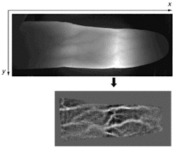 Researchers believe finger-vein patterns, shown imaged with near-infrared light by a charge-coupled-device camera (top) with the vein-pattern image enhanced (bottom), offer several advantages over other means of identification. Researchers believe finger-vein patterns, shown imaged with near-infrared light by a charge-coupled-device camera (top) with the vein-pattern image enhanced (bottom), offer several advantages over other means of identification.