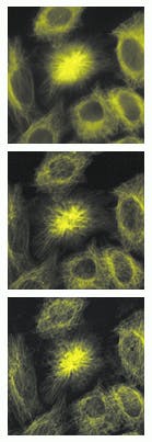 FIGURE 3. Traditional high-magnification microscope image of a dividing cell contains image blur due to shallow focal depth (top). A wavefront-coded fluorescence image shows sharp detail throughout, with the two division centers resolved (center). A confocal data set constructed of 24 images in 0.5-µm steps was averaged to form the equivalent of an extended depth of field image (bottom). The total exposure time for the confocal image was 192 s, whereas the exposure time for the wavefront-coded image was just 8 s. FIGURE 3. Traditional high-magnification microscope image of a dividing cell contains image blur due to shallow focal depth (top). A wavefront-coded fluorescence image shows sharp detail throughout, with the two division centers resolved (center). A confocal data set constructed of 24 images in 0.5-µm steps was averaged to form the equivalent of an extended depth of field image (bottom). The total exposure time for the confocal image was 192 s, whereas the exposure time for the wavefront-coded image was just 8 s.