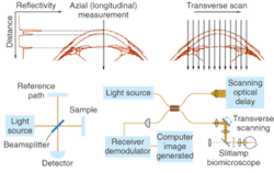 FIGURE 2. Cross-sectional OCT imagery is based on axial measurements of echo time delay and signal amplitude (top left) taken repeatedly while scanning transversely (top right). The measurements are taken interferometrically (bottom left) in a fiberoptic system (bottom right). FIGURE 2. Cross-sectional OCT imagery is based on axial measurements of echo time delay and signal amplitude (top left) taken repeatedly while scanning transversely (top right). The measurements are taken interferometrically (bottom left) in a fiberoptic system (bottom right).