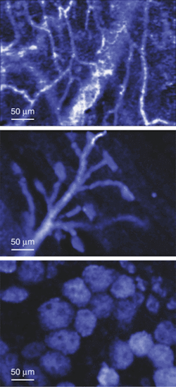 Fibered confocal microscopy allows microscopic imaging via a miniature fiberoptic probe. The inner mucosa of a female rat bladder is accessed endoscopically via the urethra, revealing prismatic binucleated cells lining the urothelium (top). The cell cytoplasm is stained by intravesical instillation of Rhodamine 123. An image of a neuromuscular junction in skeletal mouse muscle reveals both nerve and muscular fibers (center). An image of mouse mesenteric microcirculation is acquired after intravenous administration of a fluorescent contrast agent (bottom). Fibered confocal microscopy allows microscopic imaging via a miniature fiberoptic probe. The inner mucosa of a female rat bladder is accessed endoscopically via the urethra, revealing prismatic binucleated cells lining the urothelium (top). The cell cytoplasm is stained by intravesical instillation of Rhodamine 123. An image of a neuromuscular junction in skeletal mouse muscle reveals both nerve and muscular fibers (center). An image of mouse mesenteric microcirculation is acquired after intravenous administration of a fluorescent contrast agent (bottom).