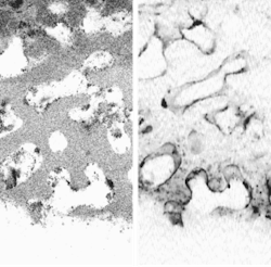 Separate OCM (left) and CFM (right) images at a 145-&micro;m depth are obtained of a cultured poly(e-caprolactone) scaffold holding fetal-chick osteoblasts. The scaffold is the gray portion in the left-hand image. Captured by the same optical system, these two images can easily be combined.