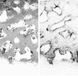 Separate OCM (left) and CFM (right) images at a 145-µm depth are obtained of a cultured poly(e-caprolactone) scaffold holding fetal-chick osteoblasts. The scaffold is the gray portion in the left-hand image. Captured by the same optical system, these two images can easily be combined. Separate OCM (left) and CFM (right) images at a 145-µm depth are obtained of a cultured poly(e-caprolactone) scaffold holding fetal-chick osteoblasts. The scaffold is the gray portion in the left-hand image. Captured by the same optical system, these two images can easily be combined.