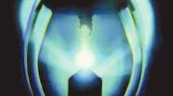 FIGURE 1. The small, bright arc of a short-arc lamp allows for great flexibility in shaping the emitted light for illumination and other uses. Proper power-supply design is crucial to the stability of an arc lamp's optical output. FIGURE 1. The small, bright arc of a short-arc lamp allows for great flexibility in shaping the emitted light for illumination and other uses. Proper power-supply design is crucial to the stability of an arc lamp's optical output.