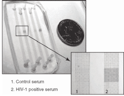 The POCKET protein detector contains a diagnostic chip for immunoassays only a few square millimeters in size. The POCKET protein detector contains a diagnostic chip for immunoassays only a few square millimeters in size.