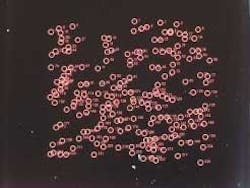 An image from the FAST cytometer results from a rough scan of a sample containing a cell line spiked in peripheral blood. The system detected 288 objects for analysis. The analysis located the four tumor cells known to be in the sample and generated three false positives. An image from the FAST cytometer results from a rough scan of a sample containing a cell line spiked in peripheral blood. The system detected 288 objects for analysis. The analysis located the four tumor cells known to be in the sample and generated three false positives.