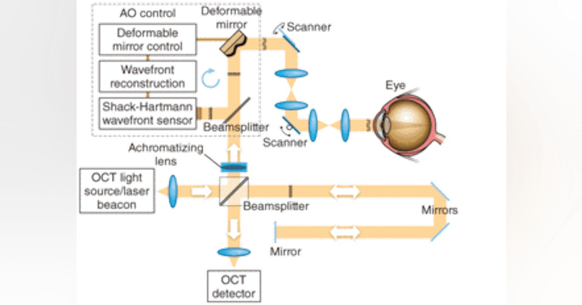 MEDICAL OCT: Ultra-high-resolution optical coherence tomography gets ...