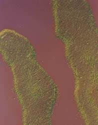 FIGURE 2. Microscopic analysis of an optic is often necessary to determine the cause of failure. In this case, a micrograph shows that the damaged areas are crescent-shaped, which is typically caused by hot spots in the beam. FIGURE 2. Microscopic analysis of an optic is often necessary to determine the cause of failure. In this case, a micrograph shows that the damaged areas are crescent-shaped, which is typically caused by hot spots in the beam.