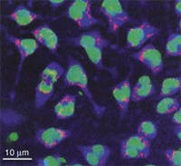 FIGURE 2. A color-enhanced image of mucosal mast cells, obtained by merging the fluorescence of red, green, and blue dyes excited by two-photon absorption. The high peak power of a modelocked Ti:sapphire laser enables this nonlinear absorption, and the tuning range of the system, along with efficient frequency doubling, covers the absorption spectra of the dyes with a single solid-state system. FIGURE 2. A color-enhanced image of mucosal mast cells, obtained by merging the fluorescence of red, green, and blue dyes excited by two-photon absorption. The high peak power of a modelocked Ti:sapphire laser enables this nonlinear absorption, and the tuning range of the system, along with efficient frequency doubling, covers the absorption spectra of the dyes with a single solid-state system.