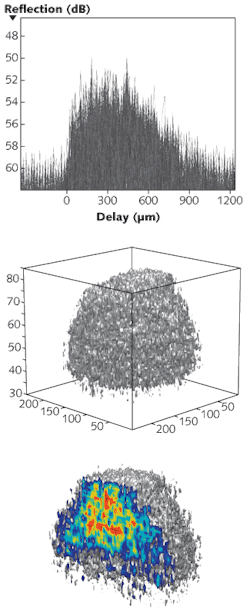 A holographic optical-coherence-imaging (HOCI) technique records depth-resolved photons scattered coherently from a tissue sample in a photorefractive polymer. Here, individual holographic images (top) are stacked to create a three-dimensional (3-D) volumetric representation of an 800-µm-diameter spheroidal rat tumor (center). The tumor can be analyzed as a whole or through a series of vertical cuts (bottom). A holographic optical-coherence-imaging (HOCI) technique records depth-resolved photons scattered coherently from a tissue sample in a photorefractive polymer. Here, individual holographic images (top) are stacked to create a three-dimensional (3-D) volumetric representation of an 800-µm-diameter spheroidal rat tumor (center). The tumor can be analyzed as a whole or through a series of vertical cuts (bottom).