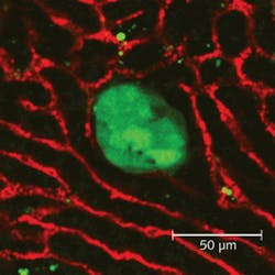 FIGURE 3. A two-photon microscopy image shows blood vessels (red) and a green-fluorescent-protein (GFP)-labeled metastatic tumor (green) located approximately 75 µm deep within an intact mouse liver. Because of the opacity of the liver tissue and density of blood vessel staining, confocal microscopy cannot achieve cellular resolution at depths beyond approximately 25 µm. FIGURE 3. A two-photon microscopy image shows blood vessels (red) and a green-fluorescent-protein (GFP)-labeled metastatic tumor (green) located approximately 75 µm deep within an intact mouse liver. Because of the opacity of the liver tissue and density of blood vessel staining, confocal microscopy cannot achieve cellular resolution at depths beyond approximately 25 µm.