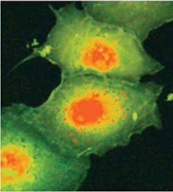 FIGURE 2. Using an ultrachrome source, a fluorescence-lifetime image is taken of Cos/cells stained with tomato and excited at 535 nm. Fluorescence lifetimes are 1.6 ns (green) and 1.9 ns (red). FIGURE 2. Using an ultrachrome source, a fluorescence-lifetime image is taken of Cos/cells stained with tomato and excited at 535 nm. Fluorescence lifetimes are 1.6 ns (green) and 1.9 ns (red).