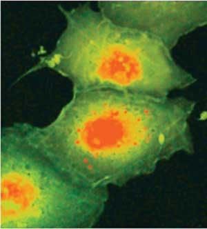 FIGURE 2. Using an ultrachrome source, a fluorescence-lifetime image is taken of Cos/cells stained with tomato and excited at 535 nm. Fluorescence lifetimes are 1.6 ns (green) and 1.9 ns (red).
