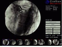 Th Lfw26140 41 Th Lfw26140 41