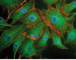 The combination of sequential fluorescent microscopy images, recorded with different filters placed in front of a CCD array, can generate high-resolution color images. These three images were recorded using filters that were matched to the emission bands of BODIPY, Texas Red, and DAPI. Different colors, each corresponding to a different dye, show the distribution of tubulin, F-actin, and nuclei in bovine pulmonary-artery endothelial cells. The combination of sequential fluorescent microscopy images, recorded with different filters placed in front of a CCD array, can generate high-resolution color images. These three images were recorded using filters that were matched to the emission bands of BODIPY, Texas Red, and DAPI. Different colors, each corresponding to a different dye, show the distribution of tubulin, F-actin, and nuclei in bovine pulmonary-artery endothelial cells.