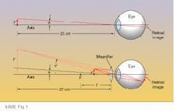FIGURE 1. The closest distance from which the normal adult eye can focus on an object (y) is about 25 cm (top), but with a magnifier, the object can be brought much closer to the eye because the eye focuses on the enlarged virtual image (y’) that appears to lie 25 cm away (bottom). FIGURE 1. The closest distance from which the normal adult eye can focus on an object (y) is about 25 cm (top), but with a magnifier, the object can be brought much closer to the eye because the eye focuses on the enlarged virtual image (y’) that appears to lie 25 cm away (bottom).