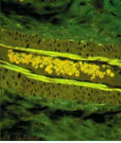 Th Lfw27441 38 Th Lfw27441 38