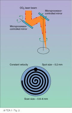 FIGURE 2. The SilkTouch beam-delivery handpiece scans the tissue in a tightly focused spiral pattern. FIGURE 2. The SilkTouch beam-delivery handpiece scans the tissue in a tightly focused spiral pattern.