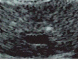 Th Lfw28590 15 Th Lfw28590 15