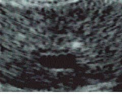 Th Lfw28590 15 Th Lfw28590 15