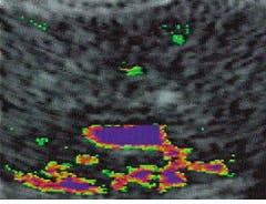 Th Lfw28590 16 Th Lfw28590 16