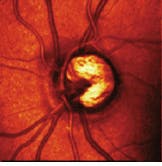 Th Lfw28613 25 Th Lfw28613 25