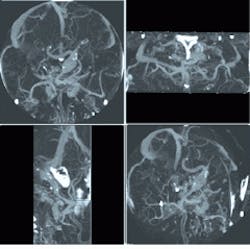 Th Lfw30014 27 Th Lfw30014 27