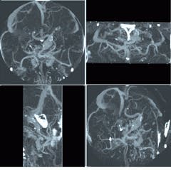 Th Lfw30014 27 Th Lfw30014 27