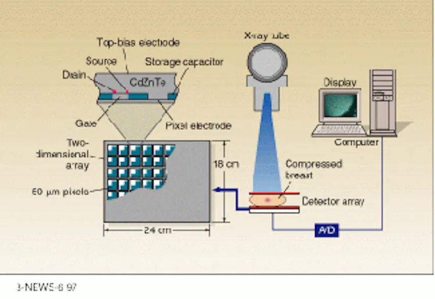 Array Flim Scanner Thin-film arrays may improve mammography | Laser Focus World
