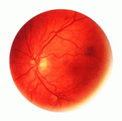 FIGURE 1. The blood-vessel pattern of the retina forms when a child develops in the womb and stays constant throughout life. The EyeDentify 2001 uses the natural reflective properties of the retina to verify a person`s identity. FIGURE 1. The blood-vessel pattern of the retina forms when a child develops in the womb and stays constant throughout life. The EyeDentify 2001 uses the natural reflective properties of the retina to verify a person`s identity.