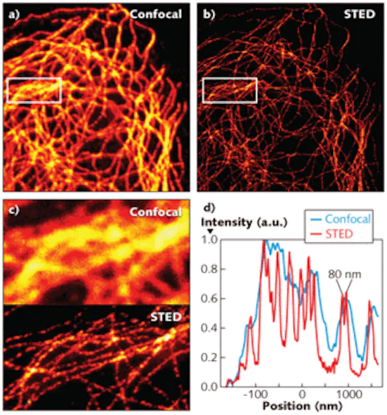 MICROSCOPY: Single-path design simplifies STED microscopy | Laser Focus ...