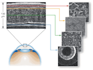 FIGURE 1. What looks like a more traditional OCT image (left) is actually a reconstruction of all slices registered during Cell OCT imaging of a rat&rsquo;s anterior eye (cornea). The Cell OCT approach enables cellular-resolution views of transverse slices (right).