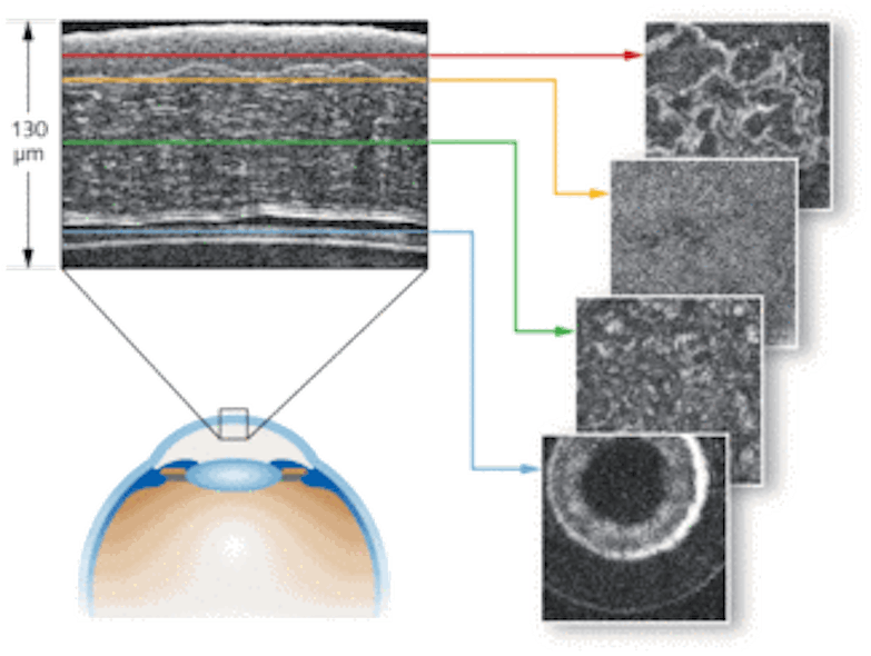 FIGURE 1. What looks like a more traditional OCT image (left) is actually a reconstruction of all slices registered during Cell OCT imaging of a rat&rsquo;s anterior eye (cornea). The Cell OCT approach enables cellular-resolution views of transverse slices (right).