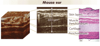 FIGURE 2. From a 3-D reconstruction of transverse Cell-OCT images of a mouse&rsquo;s ear (left), it is possible to extract a single slice (center), which compares favorably with a standard histological cut (right). In both the histology image, which required significant preparation, and the Cell OCT image, which required none, the various layers are clearly apparent.