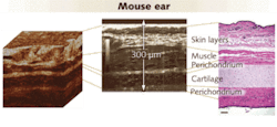 FIGURE 2. From a 3-D reconstruction of transverse Cell-OCT images of a mouse’s ear (left), it is possible to extract a single slice (center), which compares favorably with a standard histological cut (right). In both the histology image, which required significant preparation, and the Cell OCT image, which required none, the various layers are clearly apparent. FIGURE 2. From a 3-D reconstruction of transverse Cell-OCT images of a mouse’s ear (left), it is possible to extract a single slice (center), which compares favorably with a standard histological cut (right). In both the histology image, which required significant preparation, and the Cell OCT image, which required none, the various layers are clearly apparent.