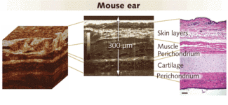 FIGURE 2. From a 3-D reconstruction of transverse Cell-OCT images of a mouse&rsquo;s ear (left), it is possible to extract a single slice (center), which compares favorably with a standard histological cut (right). In both the histology image, which required significant preparation, and the Cell OCT image, which required none, the various layers are clearly apparent.